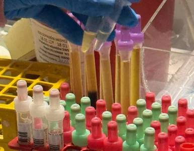 Miniatura: Viagra miała leczyć serce. Badania...