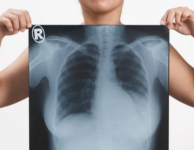 Miniatura: Interpretacja przepisów decyduje o życiu...