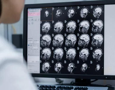 Miniatura: Jedna choroba, wiele nowotworów i...