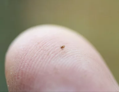 Miniatura: Masz to na ciele? Nie ignoruj. Łatwo...