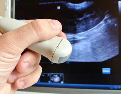 Miniatura: Masz obrzęki nóg lub bóle łydek? Sprawdź...