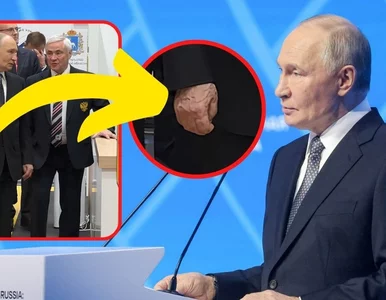 Miniatura: Powrót fali spekulacji ws. stanu zdrowia...