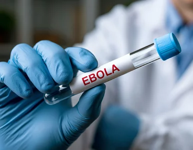 Miniatura: Ebola wróciła do Europy. Czy może pojawić...