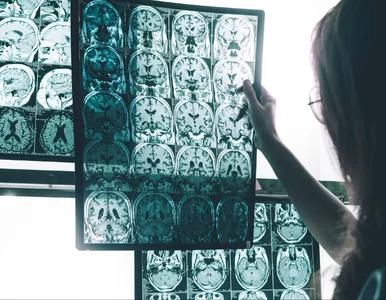Miniatura: Co się dzieje z Planem Alzheimerowskim? MZ...