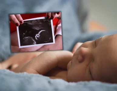 Miniatura: „Pamiętam każdy strach i każdą operację”....