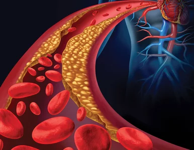 Miniatura: Poziom złego cholesterolu spadł...