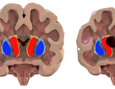 Miniatura: Nowa terapia nadzieją dla pacjentów? Na tę...