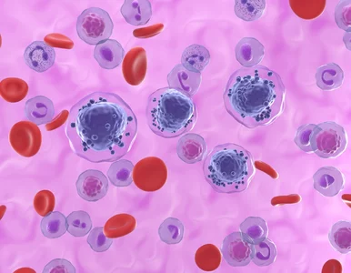 Miniatura: Białaczka. Typy i rodzaje białaczek. Który...