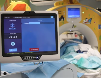 Miniatura: Guzy zamieniają w kulki lodu....