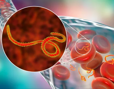 Miniatura: Epidemia Eboli, kilkadziesiąt zgonów. WHO:...