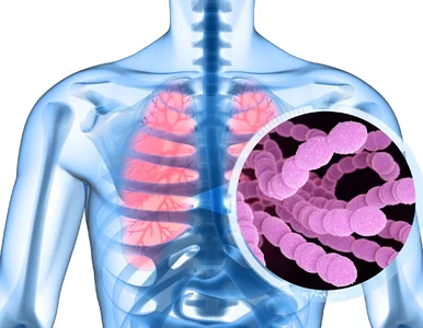 Miniatura: Eksperci: Szczepionki na pneumokoki nie są...