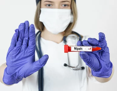 Miniatura: Śmiertelny wirus Nipah. Ważne zalecenia...