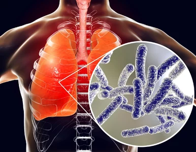 Miniatura: Legionella może namnażać się w instalacji...