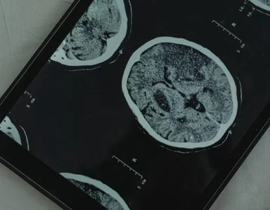 Miniatura: Twój mózg robi to podczas snu. Naukowcy...