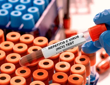 Miniatura: Chorują miliony na całym świecie....