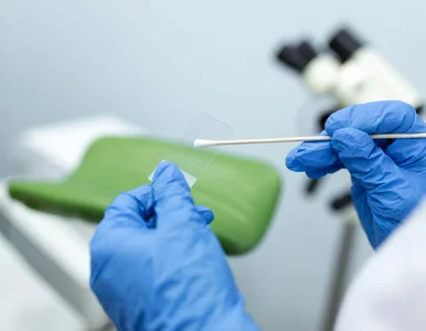 Miniatura: Cytologia, LBC i test HPV DNA – poznaj...