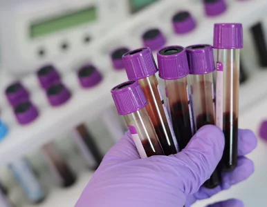 Miniatura: Morfologia. Proste badanie, które może...