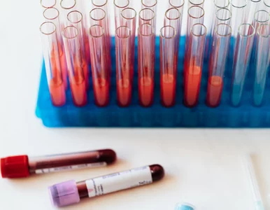 Miniatura: Testuj. Lecz. Zapobiegaj. Wczesna diagnoza...