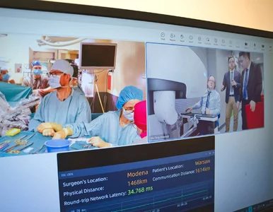 Miniatura: Polscy liderzy telechirurgii robotycznej...